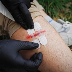 Rychlošití tržných ran